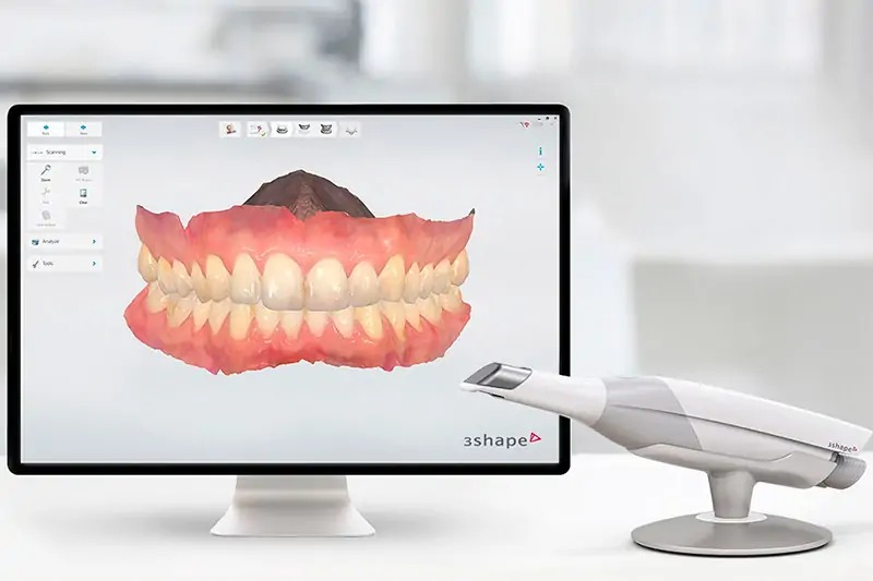 Escaneo intraoral